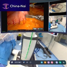 4K OR video system mSurgeryMP4MPEGAVI