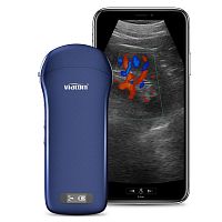 Hand-held ultrasound system C10for multipurpose ultrasound imagingB/Wcolor doppler