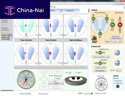 Medical software MULTITEST6vestibular rehabilitationrehabilitationfor control