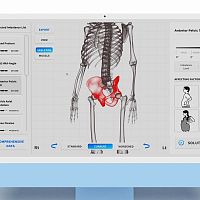 Balance evaluation system Moti Physio miniposturekinematic analysis