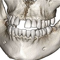 Dental software Invivo6medicalCTanalysis