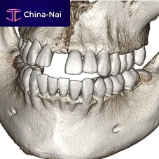 Dental software Invivo6medicalCTanalysis