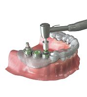 Dental surgery surgical navigation system Neo NaviGuideoptical