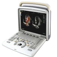 Portable ultrasound system Q5for gynecological and obstetric ultrasound imaging3D/4Dbuilt-in console
