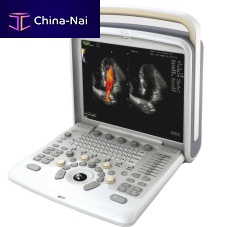 Portable ultrasound system Q5for gynecological and obstetric ultrasound imaging3D/4Dbuilt-in console