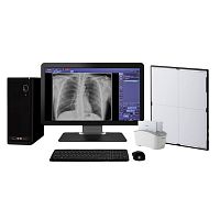 Radiography acquisition system