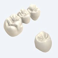 PMMA dental prosthesis compositezirconiaCoCr