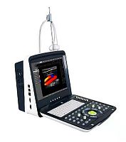 Portable ultrasound system M8for multipurpose ultrasound imagingB/Wcolor doppler