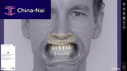 Dental software Smile Creatorfor dental laboratoriesanalysisplanning