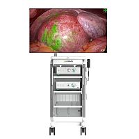 4K imaging video processor 214Kendoscopy