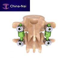 Thoraco-lumbo-sacral osteosynthesis unit BDYNposterioradult