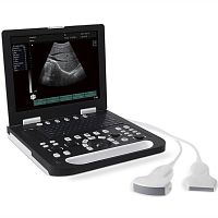 Portable ultrasound system RS-N50 for multipurpose ultrasound imagingB/Wconvex-array