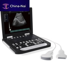 Portable ultrasound system RS-N50 for multipurpose ultrasound imagingB/Wconvex-array