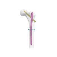 Femoral intramedullary nail trochantermetallic