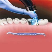 Dental polymerizer Trimax
