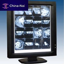 Digital X-ray film viewer LEDVIEW-3601-screenwith automatic light
