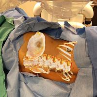 AR surgical navigation system OpenSight®spine surgeryorthopedic surgeryoptical