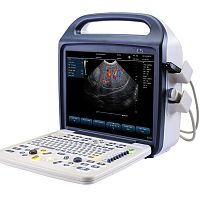 Portable ultrasound system C5Plusfor multipurpose ultrasound imagingcolor doppler