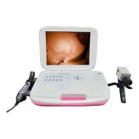 Breast cancer screening device ZJ-8000Binfrared thermography