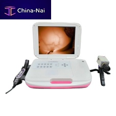 Breast cancer screening device ZJ-8000Binfrared thermography