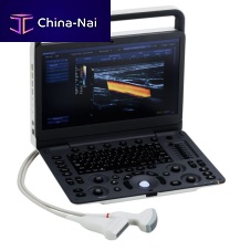 Portable ultrasound system SonidoSmart Profor musculoskeletal ultrasound imagingB/Wcolor doppler