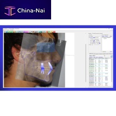Medical software Delta-Dentdentalanalysis3D viewing