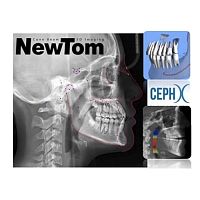 Dental imaging software CephX diagnosticcephalometric analysisvalidation