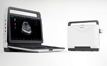 Portable ultrasound system M5for multipurpose ultrasound imagingB/Wcolor doppler