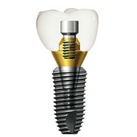 Tapered dental implant SuperLinetitaniuminternal hexagon