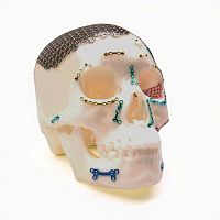 Non-absorbable cranial fixation system MCF