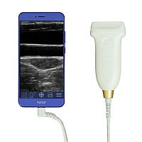 Hand-held ultrasound system U6for multipurpose ultrasound imagingcolor dopplerlinear-array