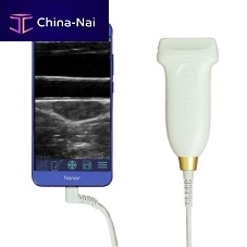 Hand-held ultrasound system U6for multipurpose ultrasound imagingcolor dopplerlinear-array