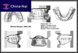 Dental laboratory software Ortho Insight 3D Full / Litefor dental prosthesis designCAD3D viewing