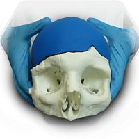 Custom-made cranial implant SkullPT