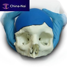 Custom-made cranial implant SkullPT