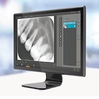 Dental imaging software QuantorDent medicaldentalimage analysis