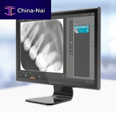 Dental imaging software QuantorDent medicaldentalimage analysis