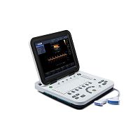 Portable ultrasound system KU1for multipurpose ultrasound imagingB/Wcolor doppler