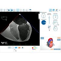 Medical software eTEEmothyfor ultrasound imagingfor echocardiographyfor cardiology
