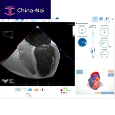 Medical software eTEEmothyfor ultrasound imagingfor echocardiographyfor cardiology