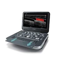 Portable ultrasound system E-CUBE i7for multipurpose ultrasound imagingcolor dopplerbuilt-in console