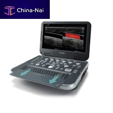 Portable ultrasound system E-CUBE i7for multipurpose ultrasound imagingcolor dopplerbuilt-in console