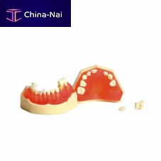 Jaw anatomical model UM-7009denturedental extractionfor teaching