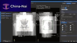 Medical imaging software MOSAIQ® 3oncologytrainingimage analysis
