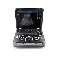 Portable ultrasound system CMS1700C for gynecological and obstetric ultrasound imagingfor abdominal and pelvic ultrasound imagingcolor doppler