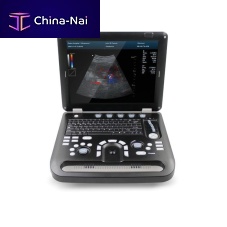 Portable ultrasound system CMS1700C for gynecological and obstetric ultrasound imagingfor abdominal and pelvic ultrasound imagingcolor doppler