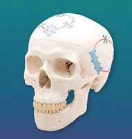 Non-absorbable cranial fixation system NeuroPro®