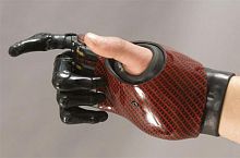 Myo-electric partial hand prosthesis multi-articulatedadult