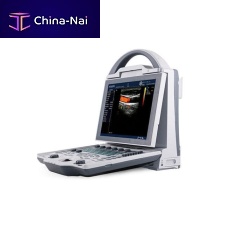 Portable ultrasound system DCU12for gynecological and obstetric ultrasound imagingB/Wcolor doppler