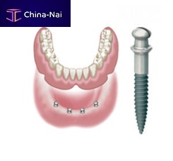 Tapered dental implant ATLAS titaniumexternalone-stage